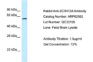 Western Blotting (WB) image for anti-Zinc Finger CCCH-Type Containing 12A (ZC3H12A) (C-Term) antibody (ABIN2789180) (ZC3H12A antibody  (C-Term))