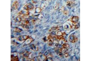 IHC-P analysis of Ovary tissue, with DAB staining. (CD83 antibody  (AA 24-205))