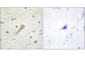 Immunohistochemistry analysis of paraffin-embedded human brain tissue, using SEMA4A Antibody.