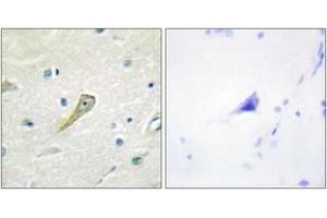 Immunohistochemistry analysis of paraffin-embedded human brain tissue, using SEMA4A Antibody. (Sema4a antibody  (AA 501-550))