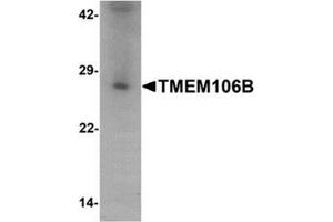 Western blot analysis of TMEM106B in human liver tissue lysate with TMEM106B antibody at 1 ug/mL. (TMEM106B antibody  (N-Term))