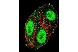 Confocal Immunofluorescent analysis of SFTPC Antibody (N-term) Cat. (Surfactant Protein C antibody  (N-Term))