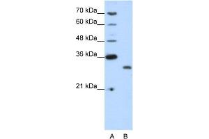 WB Suggested Anti-CPXCR1 Antibody Titration:  1. (CPXCR1 antibody  (N-Term))
