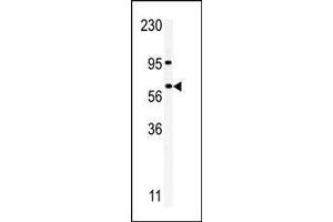 Western blot analysis of anti-RIOK1 Pab in A375 cell line lysate. (RIOK1 antibody  (C-Term))
