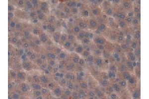 Used in DAB staining on fromalin fixed paraffin- embedded kidney tissue (Vip antibody  (AA 34-157))