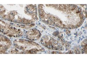 ABIN6273991 at 1/100 staining Human prostate tissue by IHC-P. (TUBA4A antibody  (N-Term))