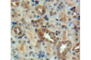 Used in DAB staining on fromalin fixed paraffin-embedded Kidney tissue (BMP7 antibody  (AA 30-431))