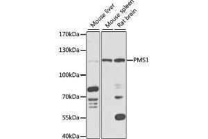 Western blot analysis of extracts of various cell lines, using PMS1 antibody (ABIN6128473, ABIN6145826, ABIN6145827 and ABIN6218265) at 1:1000 dilution.