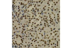 Immunohistochemistry (Paraffin-embedded Sections) (IHC (p)) image for anti-Nuclear Factor of kappa Light Polypeptide Gene Enhancer in B-Cells 2 (NFKB2) (AA 690-899) antibody (ABIN3017388)