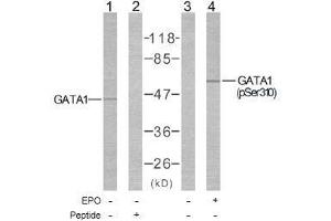Image no. 1 for anti-GATA Binding Protein 1 (Globin Transcription Factor 1) (GATA1) (Ser310) antibody (ABIN197170) (GATA1 antibody  (Ser310))