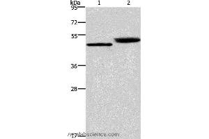 Western blot analysis of Human stomach cancer and mouse stomach tissue, using CTSE Polyclonal Antibody at dilution of 1:450 (Cathepsin E antibody)