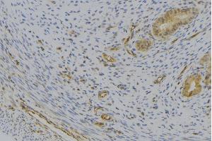 ABIN6276958 at 1/100 staining Human uterus tissue by IHC-P.