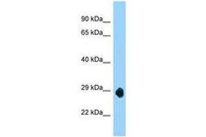 Image no. 1 for anti-Single-Pass Membrane Protein with Coiled-Coil Domains 3 (SMCO3) (AA 80-129) antibody (ABIN6748263) (C12orf69 antibody  (AA 80-129))