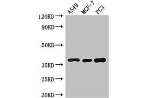Western Blot Positive WB detected in: A549 whole cell lysate, MCF-7 whole cell lysate, PC-3 whole cell lysate All lanes: SLC9A3R2 antibody at 3 μg/mL Secondary Goat polyclonal to rabbit IgG at 1/50000 dilution Predicted band size: 38, 37, 25 kDa Observed band size: 38 kDa (SLC9A3R2 antibody  (AA 106-313))