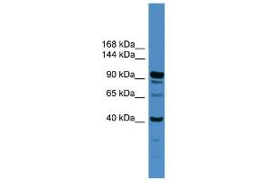 WB Suggested Anti-IFT88 Antibody Titration: 0. (IFT88 antibody  (Middle Region))