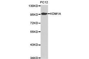 Western Blotting (WB) image for anti-Lysine (K)-Specific Demethylase 1A (KDM1A) antibody (ABIN1873389) (LSD1 antibody)