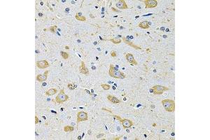 Immunohistochemistry of paraffin-embedded mouse brain using FASTKD1 Antibody. (FASTKD1 antibody  (AA 638-847))