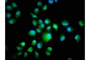 Immunofluorescence staining of Hela cells with ABIN7146862 at 1:266, counter-stained with DAPI. (CK1 epsilon antibody  (Isoform epsilon))