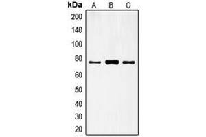 Western blot analysis of FSHR expression in HeLa (A), A431 (B), H1299 (C) whole cell lysates.