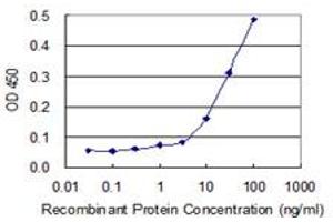 Detection limit for recombinant GST tagged AUH is 3 ng/ml as a capture antibody. (AUH antibody  (AA 44-135))