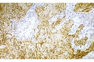 Image no. 1 for anti-Vimentin (VIM) antibody (ABIN335382) (Vimentin antibody)