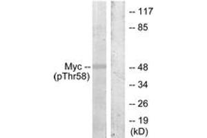 Western Blotting (WB) image for anti-Myc Proto-Oncogene protein (MYC) (pThr58) antibody (ABIN2888478) (c-MYC antibody  (pThr58))