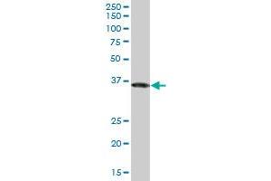 GAPDH monoclonal antibody (M03), clone 1G5. (GAPDH antibody  (AA 226-335))