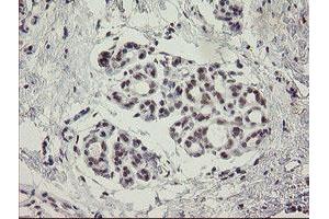 Image no. 1 for anti-Myoneurin (MYNN) (AA 10-300) antibody (ABIN1490792) (Myoneurin antibody  (AA 10-300))