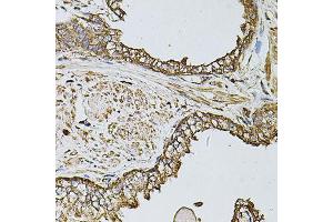 Immunohistochemistry of paraffin-embedded human prostate using FDX1 antibody (ABIN6003547) at dilution of 1/100 (40x lens).