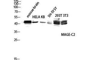 Western Blot (WB) analysis of Mouse Brain HeLa KB SH-SY5Y 293T 3T3 lysis using MAGE-C2 antibody. (MAGEC2 antibody  (Internal Region))