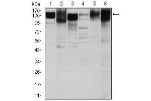 Western blot analysis using ITGB1 mouse mAb against Hela (1), HepG2 (2), A549 (3), Jurkat(4), L1210 (5) and Cos7 (6) cell lysate. (ITGB1 antibody)
