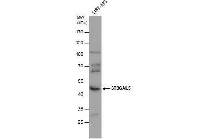 WB Image ST3GAL5 antibody detects ST3GAL5 protein by western blot analysis. (ST3GAL5 antibody)