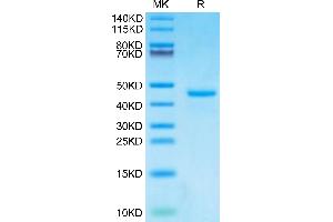Human PTH on Tris-Bis PAGE under reduced condition. (PTH Protein (AA 32-115) (Fc Tag))