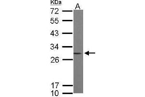 WB Image Sample (50 ug of whole cell lysate) A: mouse brain 12% SDS PAGE antibody diluted at 1:10000 (ARHGDIA antibody)