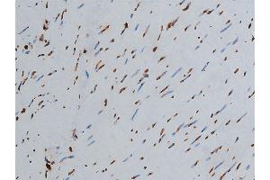 Immunohistochemistry (IHC) image for anti-Histone 3 (H3) (H3K9ac) antibody (ABIN6254904)