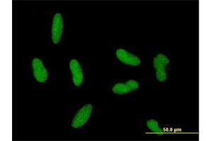 Immunofluorescence of purified MaxPab antibody to ZNF461 on HepG2 cell. (ZNF461 antibody  (AA 1-563))