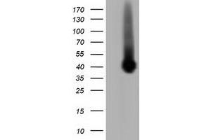 Western Blotting (WB) image for anti-Pleckstrin (PLEK) antibody (ABIN1500271) (Pleckstrin antibody)