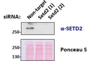 SETD2 Antibody (0. (SETD2 antibody  (Internal Region))