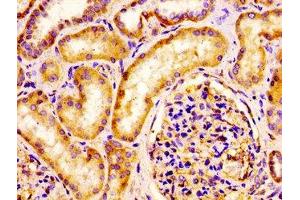 IHC image of ABIN7157026 diluted at 1:100 and staining in paraffin-embedded human kidney tissue performed on a Leica BondTM system. (IQCB1 antibody  (AA 445-598))