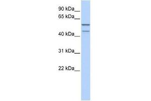Western Blot showing ZNF474 antibody used at a concentration of 1-2 ug/ml to detect its target protein. (ZNF474 antibody  (N-Term))