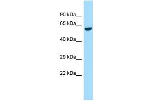 Host:  Rabbit  Target Name:  Galnt2  Sample Type:  Rat Kidney lysates  Antibody Dilution:  1. (GALNT2 antibody  (C-Term))