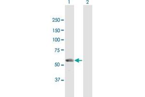 Western Blot analysis of UTP18 expression in transfected 293T cell line by UTP18 MaxPab polyclonal antibody. (UTP18 antibody  (AA 1-521))