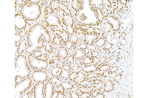 Immunohistochemistry (IHC) image for anti-U2 Small Nuclear RNA Auxiliary Factor 1 (U2AF1) (AA 140-190) antibody (ABIN7453889) (U2AF1 antibody  (AA 140-190))