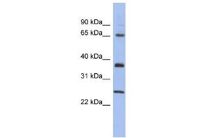 WB Suggested Anti-HORMAD2 Antibody Titration: 0. (HORMAD2 antibody  (Middle Region))