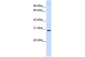 WB Suggested Anti-SLC25A20 Antibody Titration:  0. (SLC25A20 antibody  (C-Term))