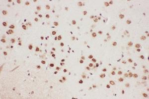 Anti-ALOX5 Picoband antibody,  IHC(P): Mouse Brain Tissue (ALOX5 antibody  (AA 120-483))