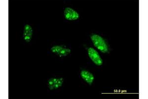 Immunofluorescence (IF) image for anti-Caudal Type Homeobox 1 (CDX1) (AA 126-215) antibody (ABIN514322)