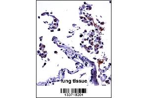 IL13 Antibody immunohistochemistry analysis in formalin fixed and paraffin embedded human lung tissue followed by peroxidase conjugation of the secondary antibody and DAB staining. (IL-13 antibody  (C-Term))