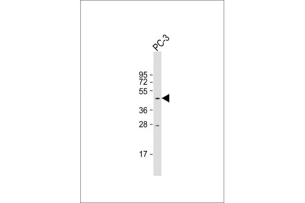 TAM41 anticorps  (AA 180-208)