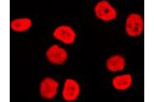 Immunofluorescence (IF) image for anti-SWI/SNF Related, Matrix Associated, Actin Dependent Regulator of Chromatin, Subfamily C, Member 2 (SMARCC2) (Center) antibody (ABIN7299454)